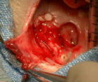 View of surgery in progress - click to enlarge